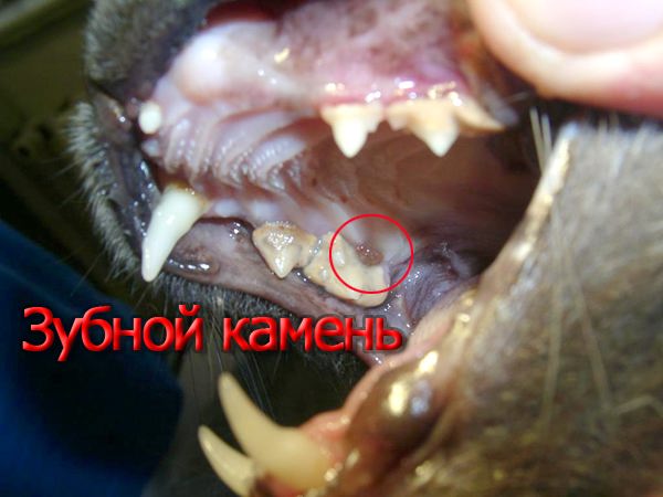 Зубной налёт и камень